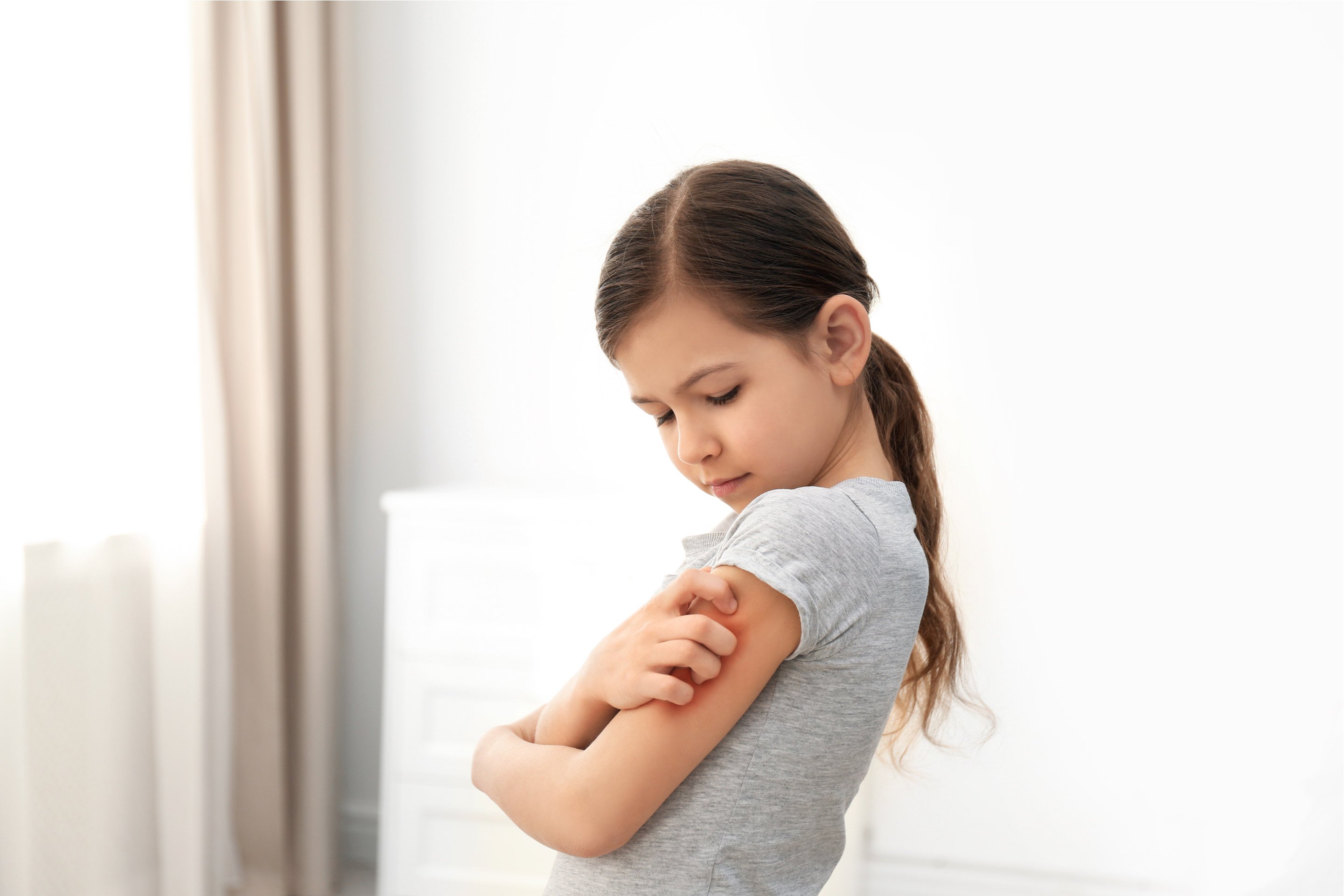 Rashes in Kids: age-by-age skin condition guide - Today's Parent